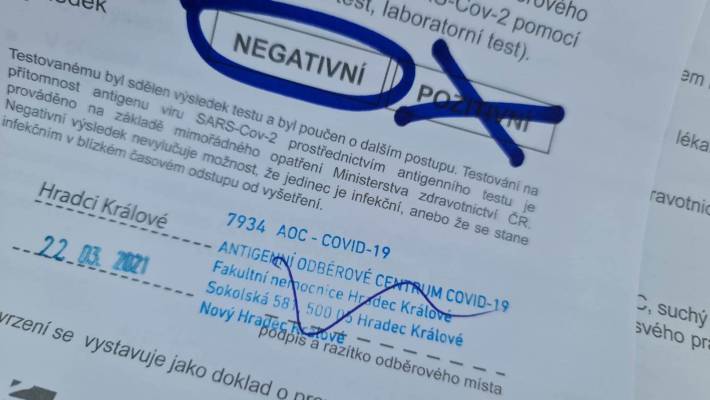 Odběrové centrum COVID-19 ve fakultní nemocnici ukončí k 1. březnu svůj provoz